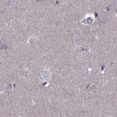 Immunohistochemistry-Paraffin: ODF3 Antibody [NBP2-32628]