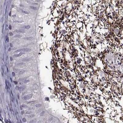 Immunohistochemistry-Paraffin: ODF3 Antibody [NBP2-32628]
