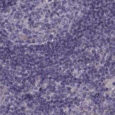Immunohistochemistry-Paraffin: ODF3 Antibody [NBP2-32628]