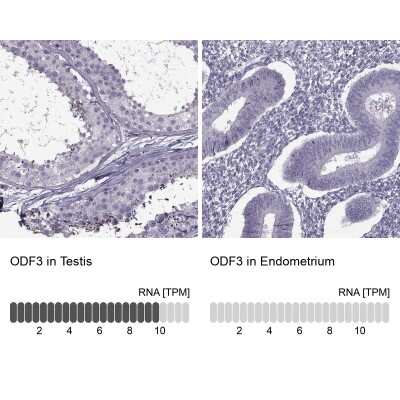 Immunohistochemistry-Paraffin: ODF3 Antibody [NBP1-90614]