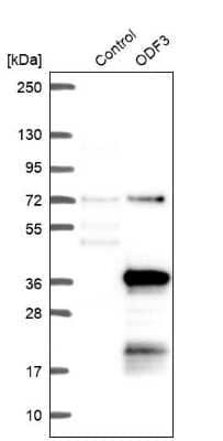 Western Blot: ODF3 Antibody [NBP2-32628]