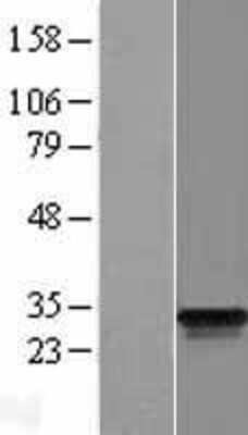 Western Blot: ODF3 Overexpression Lysate [NBP2-05816]