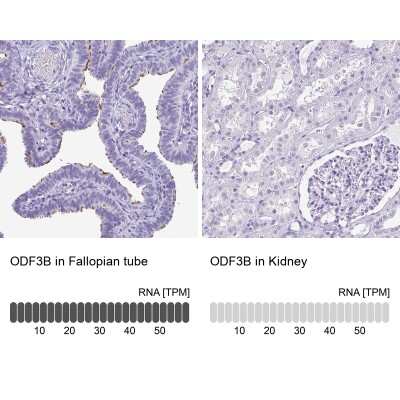 Immunohistochemistry-Paraffin: ODF3B Antibody [NBP2-32371]