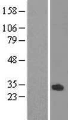 Western Blot: ODF3L1 Overexpression Lysate [NBL1-13909]