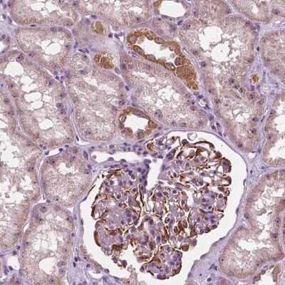 Immunohistochemistry: ODF3L2 Antibody [NBP2-38113]