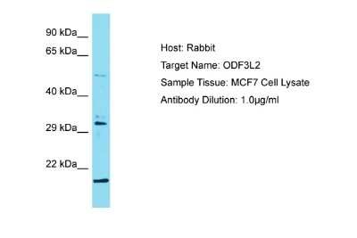 Western Blot: ODF3L2 Antibody [NBP2-83305]