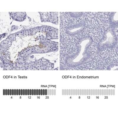 Immunocytochemistry/ Immunofluorescence: ODF4 Antibody [NBP3-17139]