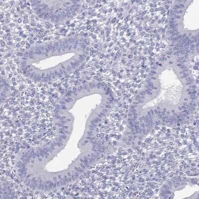 Immunohistochemistry-Paraffin: ODF4 Antibody [NBP3-17139]