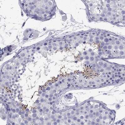 Immunohistochemistry-Paraffin: ODF4 Antibody [NBP3-17139]
