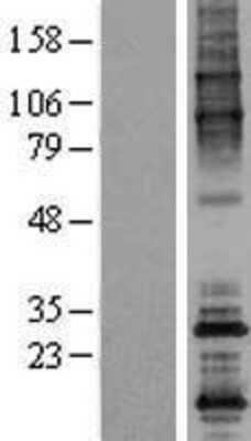 Western Blot: ODF4 Overexpression Lysate [NBL1-13910]