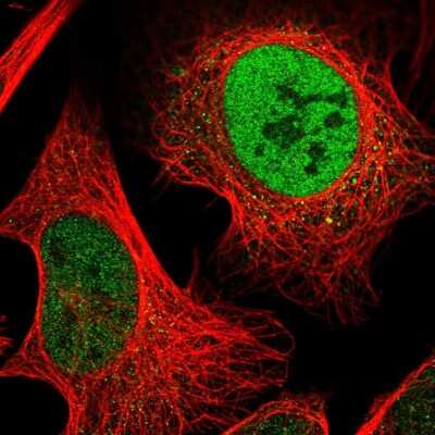 Immunocytochemistry/ Immunofluorescence: ODR4/TTG1 Antibody [NBP2-58718]