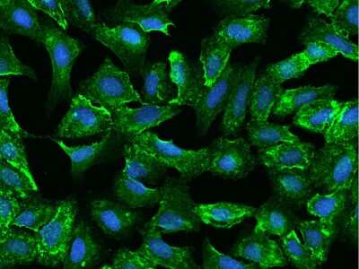 Immunocytochemistry/ Immunofluorescence: ODR4/TTG1 Antibody [NBP2-98046]