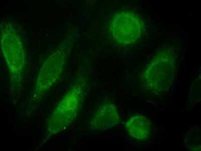 Immunocytochemistry/ Immunofluorescence: ODZ3 Antibody [NBP1-20956]