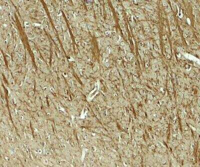 Immunohistochemistry: ODZ3 Antibody - BSA Free [NBP2-81974]