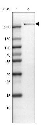 Western Blot: ODZ3 Antibody [NBP2-13687]