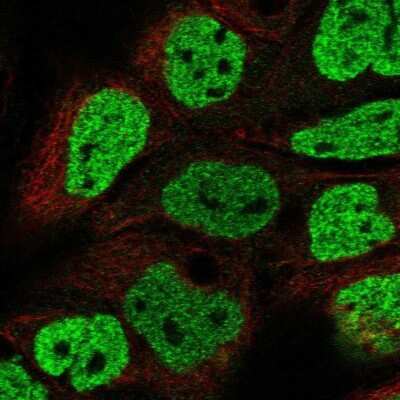 Immunocytochemistry/ Immunofluorescence: OFCC1 Antibody [NBP2-68692]