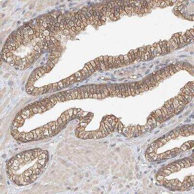 Immunohistochemistry: OFD1 Antibody [NBP1-89354]