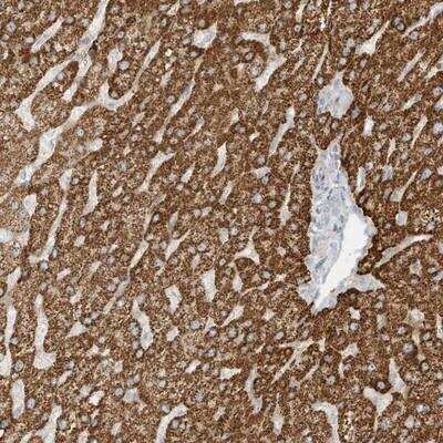 Immunohistochemistry-Paraffin: OFD1 Antibody [NBP1-89356]