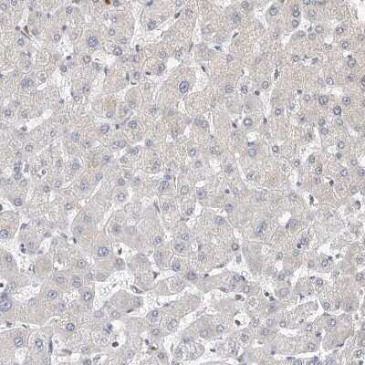 Immunohistochemistry-Paraffin: OFD1 Antibody [NBP1-89354]