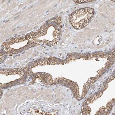 Immunohistochemistry-Paraffin: OFD1 Antibody [NBP1-89354]