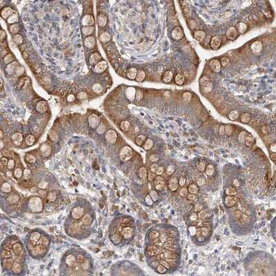 Immunohistochemistry-Paraffin: OFD1 Antibody [NBP1-89354]