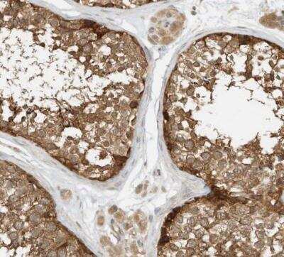 Immunohistochemistry-Paraffin: OFD1 Antibody [NBP1-89355]