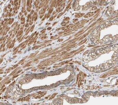 Immunohistochemistry-Paraffin: OFD1 Antibody [NBP1-89355]