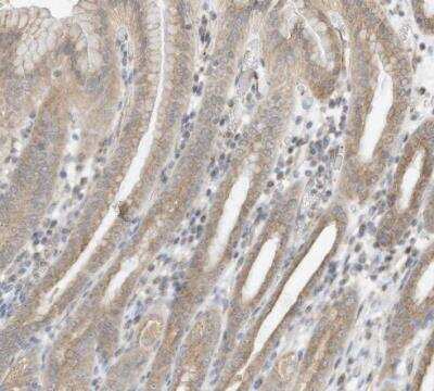 Immunohistochemistry-Paraffin: OFD1 Antibody [NBP1-89355]