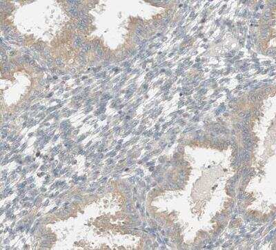 Immunohistochemistry-Paraffin: OFD1 Antibody [NBP1-89355]