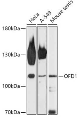 Western Blot: OFD1 AntibodyAzide and BSA Free [NBP2-94231]