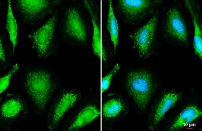 Immunocytochemistry/ Immunofluorescence: OGDH Antibody [NBP2-19622]