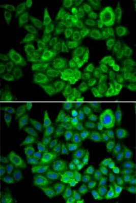 Immunocytochemistry/ Immunofluorescence: OGDH Antibody - Azide and BSA Free [NBP2-93877]