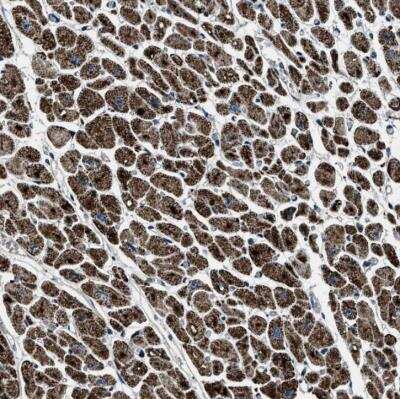 Immunohistochemistry-Paraffin: OGDH Antibody [NBP1-84947]