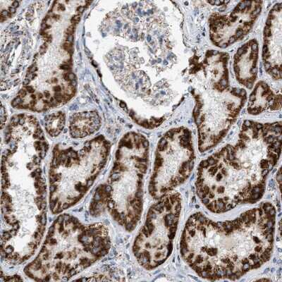 Immunohistochemistry-Paraffin: OGDH Antibody [NBP1-84948]
