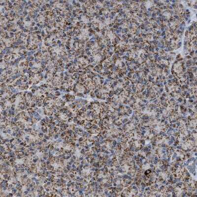 Immunohistochemistry-Paraffin: OGDH Antibody [NBP1-84948]