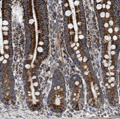 Immunohistochemistry-Paraffin: OGDH Antibody [NBP1-84948]