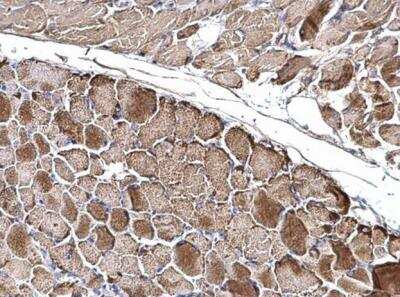 Immunohistochemistry-Paraffin: OGDH Antibody [NBP2-19622]