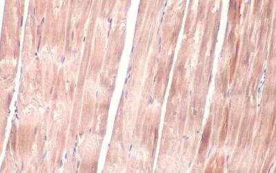Immunohistochemistry-Paraffin: OGDH Antibody [NBP2-19622]