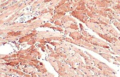 Immunohistochemistry-Paraffin: OGDH Antibody [NBP2-19622]