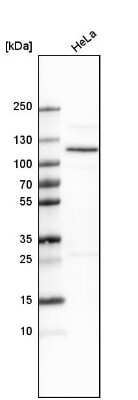 Western Blot: OGDH Antibody [NBP1-84948]