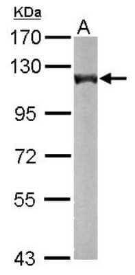 Western Blot: OGDH Antibody [NBP2-19622]