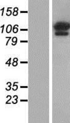 Western Blot: OGDH Overexpression Lysate [NBP2-08097]