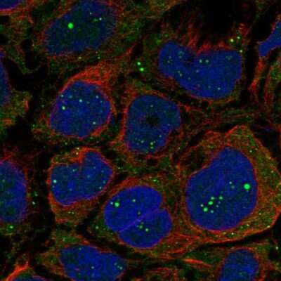 Immunocytochemistry/ Immunofluorescence: OGDHL Antibody [NBP2-30896]