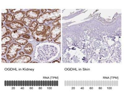 Immunohistochemistry-Paraffin: OGDHL Antibody [NBP2-30896]