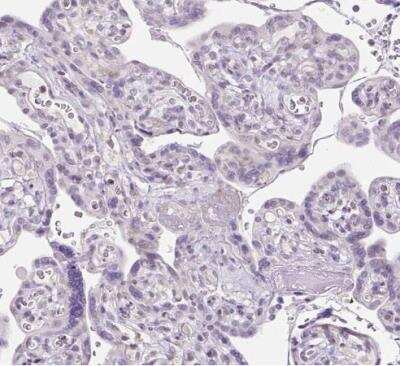 Immunohistochemistry-Paraffin: OGDHL Antibody [NBP2-30896]