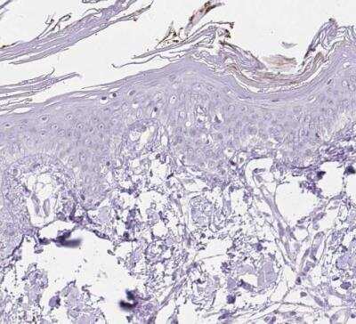 Immunohistochemistry-Paraffin: OGDHL Antibody [NBP2-30896]