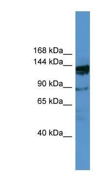 Western Blot: OGDHL Antibody [NBP1-91486]