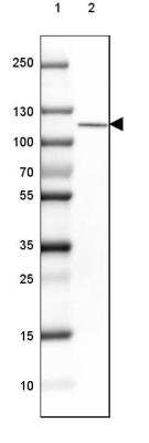 Western Blot: OGDHL Antibody [NBP2-30896]
