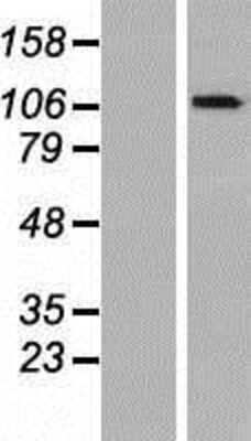 Western Blot: OGDHL Overexpression Lysate [NBP2-06836]