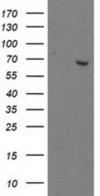 Western Blot: OGFOD1 Antibody (OTI1D9) [NBP2-00528]